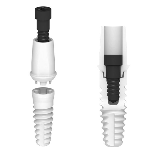 Aufbau Keramikimplantat Aufbau Keramikimplantat